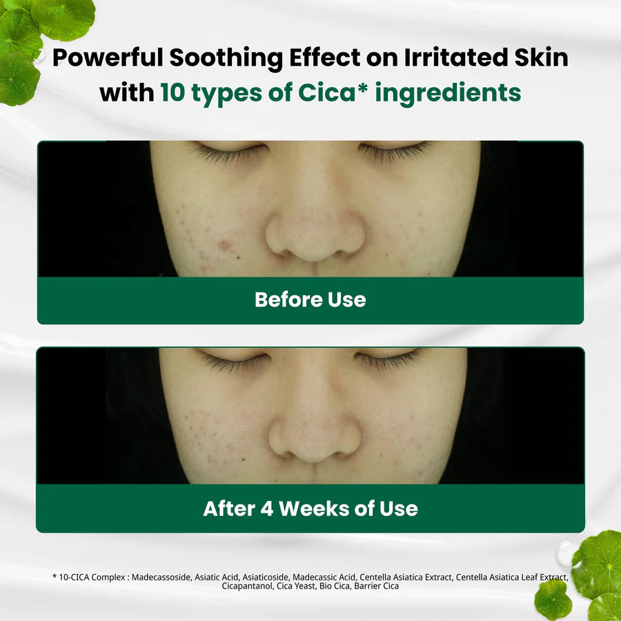 Dr.G - R.E.D Blemish Clear Soothing Cream 70ml